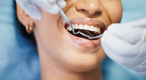 Best Chipped Tooth Repair Near Me  in Fair Oaks, GA